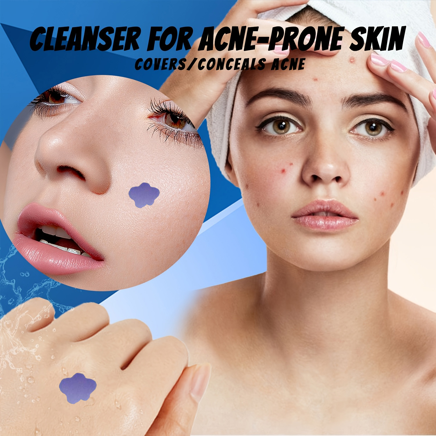 Microneedle Acne Pimple Patch  - Skincare Acne recensie en prijs