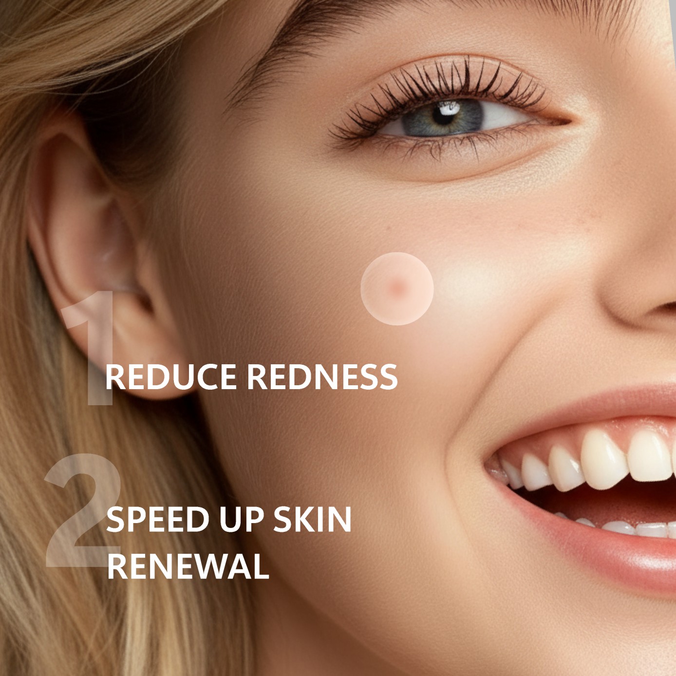 Micro Needle Pimple Patch (24  - Skincare Moisturizer recensie en prijs