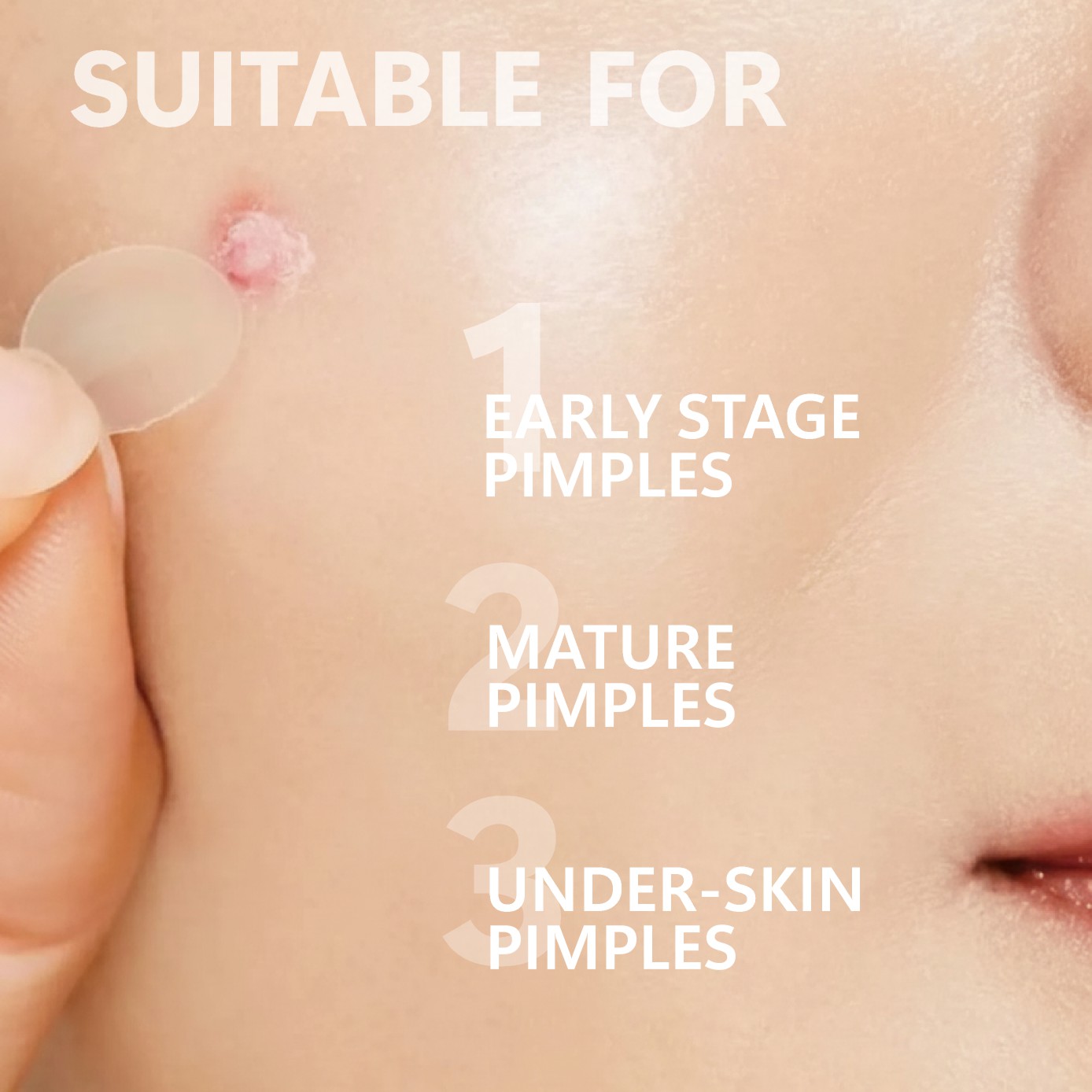 Micro Needle Pimple Patch (24  - Skincare Moisturizer recensie en prijs