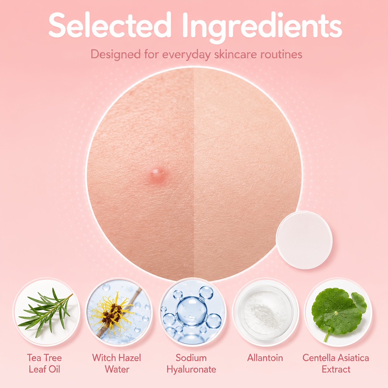 240/480/720 stuks Hydrocolloïd - Tea Tree Spot Treatment recensie en prijs