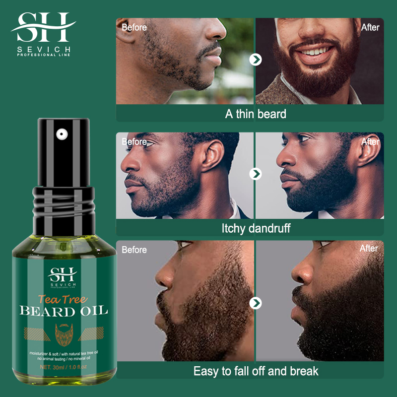 Tea Tree Baardolie Set Voor Ma - Tea Tree Spot Treatment recensie en prijs